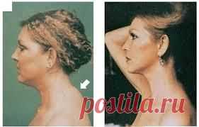 "Вдовий горбик": такое безобразие нам ни к чему!