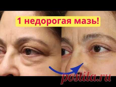 ВСЕГО 1 мазь! Как убрать мешки под глазами, морщины под глазами, отеки век , синяки под глазами.