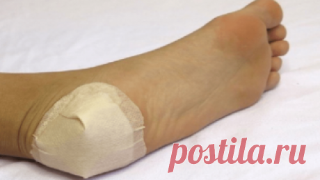 КАК ВЫЛЕЧИТЬ ПЯТОЧНЫЕ ШПОРЫ?
Рецепт лечения пяточной шпоры и шишек возле большого пальца ноги.
Его мне дал молодой врач лет 15 назад.
Он сказал: «Больничный лист по этому поводу я выписать не могу, не положено. Но моя…