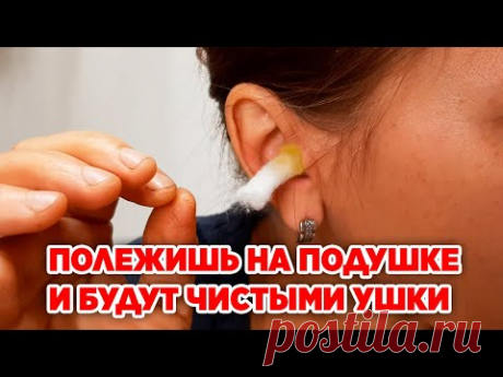 В МИГ ВЫЛЕТАЮТ СЕРНЫЕ ПРОБКИ /КАК ПОЧИСТИТЬ УШИ ОТ СЕРЫ