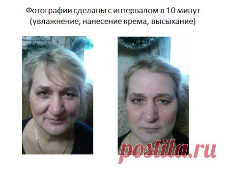 Использование  в домашних условиях микрокрема на морщинах  и отеках вокруг глаз, на  межбровной морщине, носогубных морщинах, щеках, на поперечных морщинах лба, радиальных морщинах вокруг губ.
