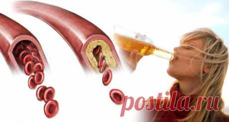 10 полезных причин, по которым вы должны пить пиво Вы будете удивлены! Все мы признаем, что пиво — это алкогольный напиток, который люди обычно предпочитают пить с определенной едой, особенно на Севере: в США и Европе. Пиво имеет больше содержания белка и витамина B, чем вино, даже если его антиоксидантное содержание эквивалентно содержанию вина. Хмель, основной аспект пивоварения пива, является богатым источником флавоноидов, которые могут быть прочными антиоксидантами.