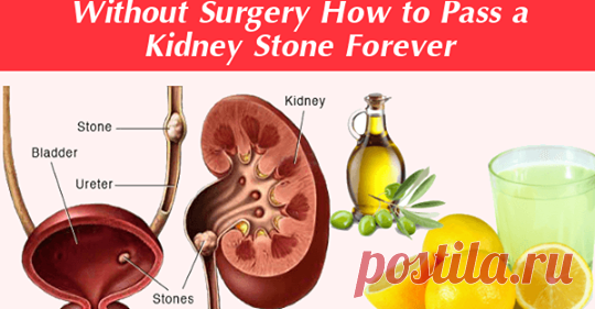 Как устранить камень в почках навсегда в течение 24 часов без хирургии (100% действие)
