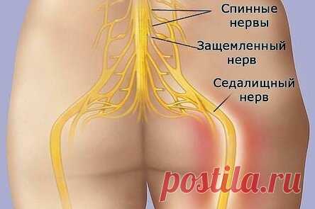 КАК РАЗБЛОКИРОВАТЬ СЕДАЛИЩНЫЙ НЕРВ