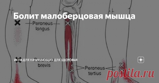 Болит малоберцовая мышца Статья автора «Йога для начинающих для здоровья» в Дзене ✍: Малоберцовые мышцы — важные структуры голени, которые часто болят и могут вызывать триггерные точки, ограничивая движения.
