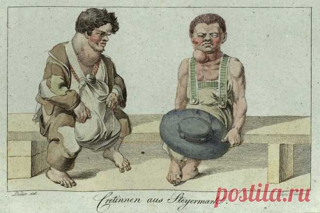 История йододефицита: чем выше в горы, тем больше кретинизма — Живой Журнал