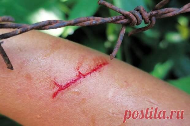 Как лечить порезы, проколы и другие летние раны
Лето – время ран, порезов, царапин, у детей – из-за более активных игр, у взрослых – из-за работы на даче. Как и чем их лечить, чтобы не было осложнений? «Нетяжёлые травмы обычно лечат самостоятельно. Но надо понимать, что они могут приводить к серьёзным проблемам, – говорит травматолог, заведующий отделением травматологии и ортопедии Балашихинской...
Читай пост далее на сайте. Жми ⏫ссылку выше