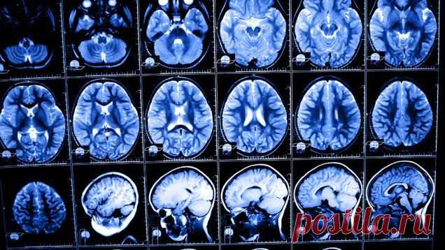 Спасите своих детей от цифрового слабоумия. И это не шутка! | Настройка Здоровья