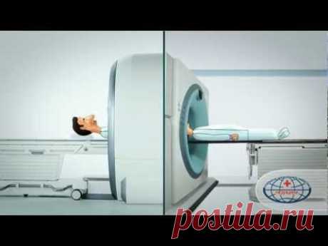 Методы диагностики инфарктов мозга | helpinsult.ru