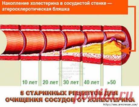 5 СТАРИННЫХ РЕЦЕПТОВ ДЛЯ ОЧИЩЕНИЯ СОСУДОВ ОТ ХОЛЕСТЕРИНА.