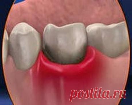 Мазь для десен