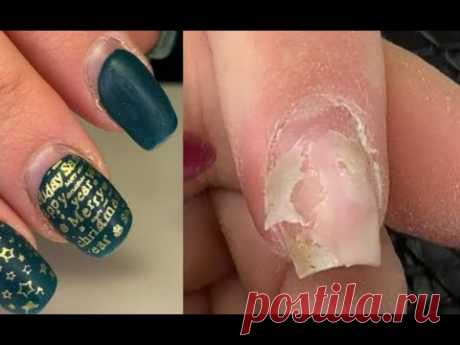 Жуткие отслойки😱Думала не исправлю😐Причины отслоек гель лака💅Преображение ногтей - YouTube