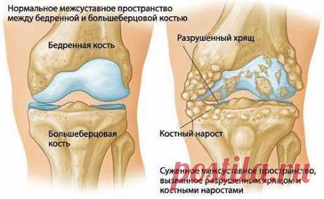 Диета для здоровых суставов.