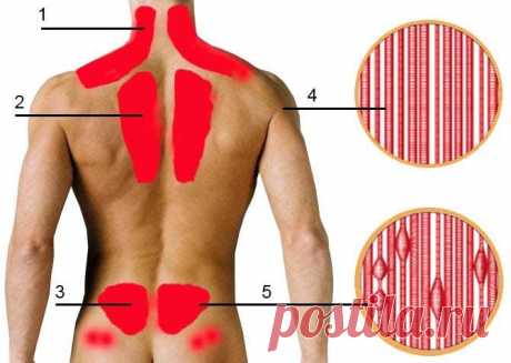 Миозит: симптомы и лечение, что это за болезнь мышц, как лечить в домашних условиях медикаментами, препаратами, признаки хронической Миозит, симптомы и лечение которого зависят от вида заболевания, может развиваться самостоятельно или же на фоне других патологий (например, таких как туберкулез). Нередко развитие миозита может повлечь за собой возникновение различных аутоиммунных болезней (ревматоидный артрит, красная системная волчанка и т. д.). Самой тяжелой формой такого...