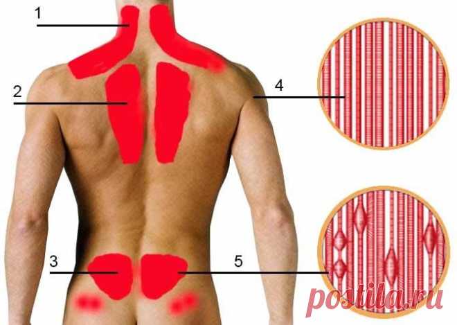 Миозит: симптомы и лечение, что это за болезнь мышц, как лечить в домашних условиях медикаментами, препаратами, признаки хронической Миозит, симптомы и лечение которого зависят от вида заболевания, может развиваться самостоятельно или же на фоне других патологий (например, таких как туберкулез). Нередко развитие миозита может повлечь за собой возникновение различных аутоиммунных болезней (ревматоидный артрит, красная системная волчанка и т. д.). Самой тяжелой формой такого...