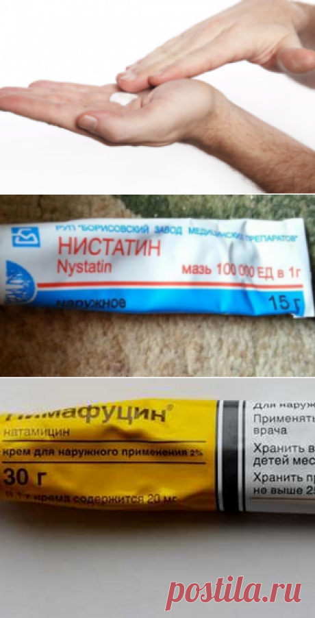 Мази от молочницы для мужчин: обзор доступных и эффективных наружных средств | Грибковые заболевания