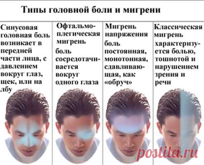 РЕЦЕПТЫ ОТ ГОЛОВНОЙ БОЛИ