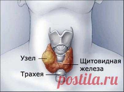 Лучшие рецепты народной медицины от болезни щитовидной железы