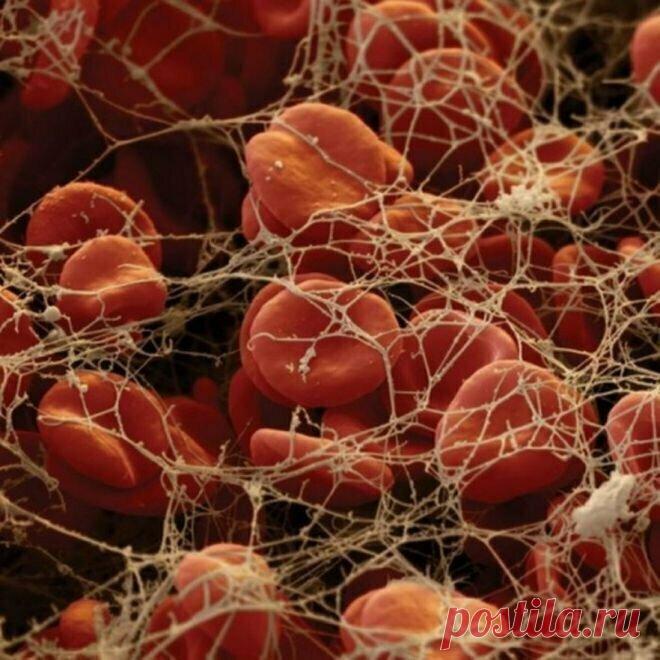 Обычные вещи под микроскопом выглядят как фантастический мир) | PRO ART | Яндекс Дзен