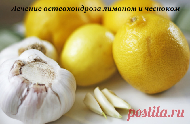 Лечение остеохондроза лимоном и чесноком