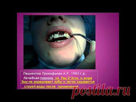 Чайная терапия | Друг пенсионера
Знаете ли вы, что зеленый чай — это не только вкусный и полез­ный напиток, но и замечательное средство для очистки зубов, де­сен и горла.