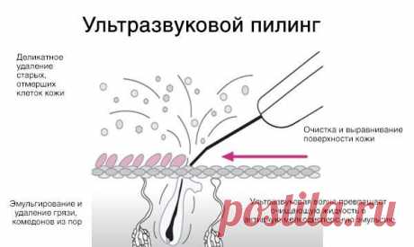 Аппарат для ультразвуковой чистки лица BioSonic 2000 Gezatone