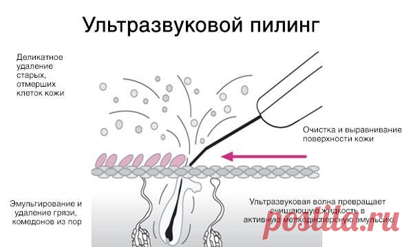 Аппарат для ультразвуковой чистки лица BioSonic 2000 Gezatone