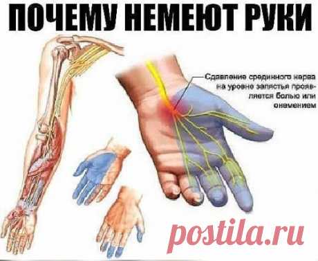 Почему немеют руки: 7 причин, заставляющих задуматься о здоровье. 
Каждому человеку не раз приходилось сталкиваться с ощущением потери чувствительности ноги или руки, сопровождающимся легким покалыванием или жжением. Зачастую это происходит из-за временного нарушения кровообращения в конечности вследствие сдавливания сосудов и нервных окончаний. Стоит начать двигаться или сменить положение, и чувствительность восстанавливается. 
И всё-таки неудобное положение во время сна, к сожалению, не единст