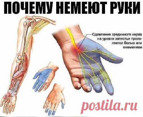 Почему немеют руки: 7 причин, заставляющих задуматься о здоровье. 
Каждому человеку не раз приходилось сталкиваться с ощущением потери чувствительности ноги или руки, сопровождающимся легким покалыванием или жжением. Зачастую это происходит из-за временного нарушения кровообращения в конечности вследствие сдавливания сосудов и нервных окончаний. Стоит начать двигаться или сменить положение, и чувствительность восстанавливается. 
И всё-таки неудобное положение во время сна, к сожалению, не единст