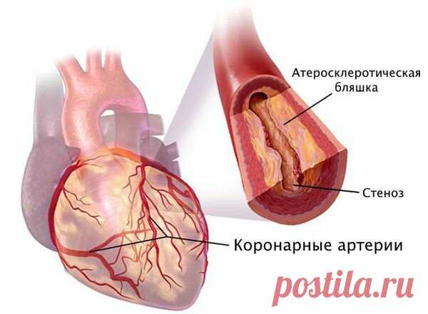 Как понять, что болит именно сердце. Симптомы. | Кардиолог Константин Крулёв | Дзен