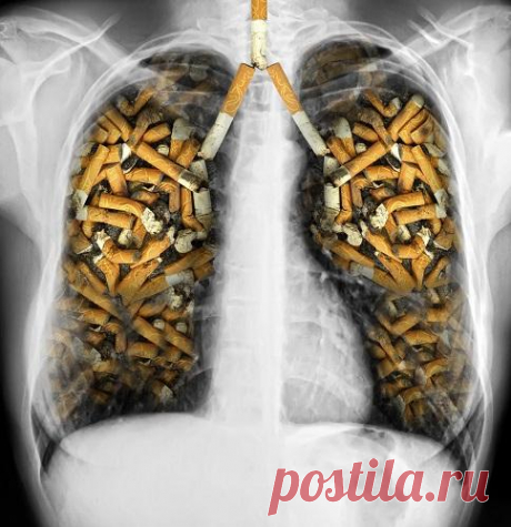 ЛЕГКИЕ КУРЯЩЕГО-4095_2.jpg (484×500)