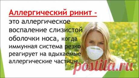 Аллергический ринит: код по МКБ10, симптомы и признаки у взрослых, бывает ли температура, как отличить от простудного насморка