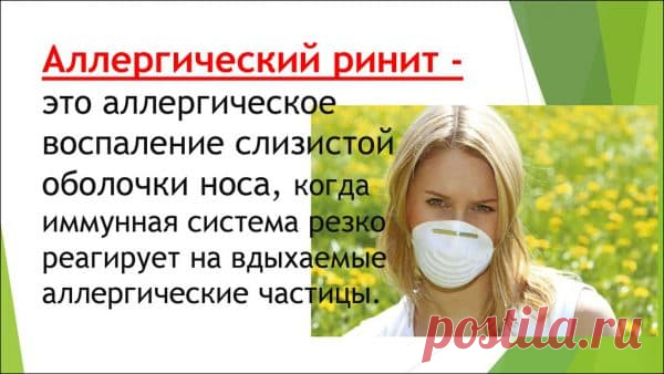 Аллергический ринит: код по МКБ10, симптомы и признаки у взрослых, бывает ли температура, как отличить от простудного насморка