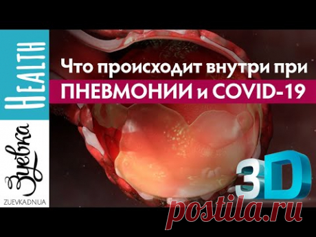 Что будет, если вы подхватите коронавирус? 3D анимация