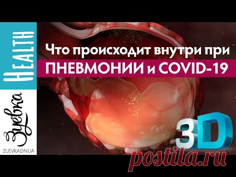 Что будет, если вы подхватите коронавирус? 3D анимация
