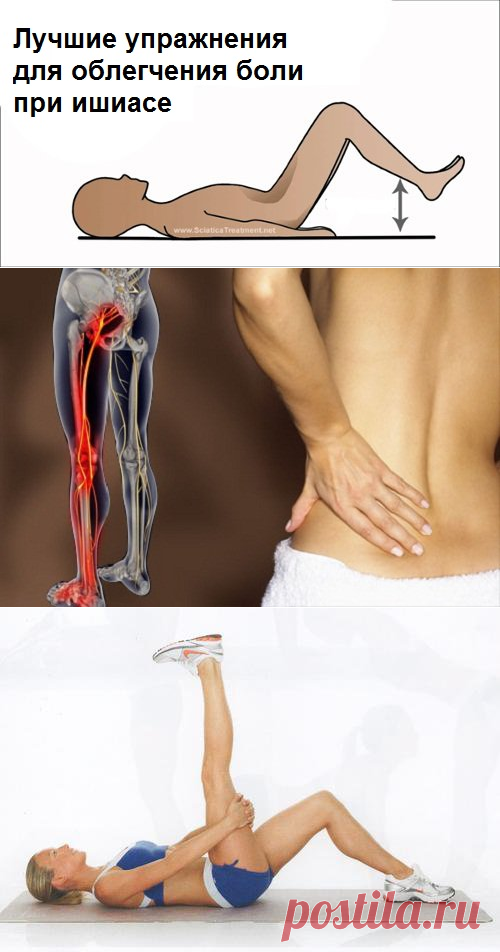 Зарядка при защемлении поясницы. Упражнения при болях в седалищном нерве. Упражнения для снятия боли при защемлении седалищного нерва. Защемило седалищный нерв гимнастика. Комплекс упражнений для спины и пресса.