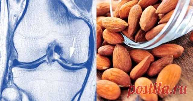 Эти 7 продуктов усиливают хрящи костей и быстро восстанавливают их