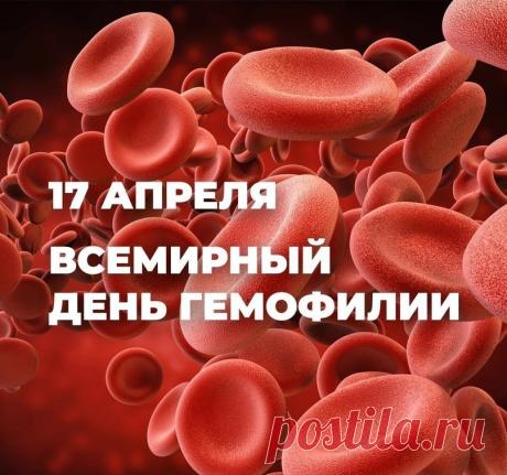 "В день гемофилии желаем вам силы,
Чтоб жизнь была радостной, очень красивой.
Пусть факторы крови всегда будут в норме,
И будете вы в замечательной форме! Открытки на Всемирный день гемофилии!"