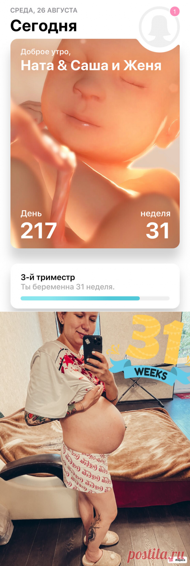 31 неделя двойне. Начинается томительное ожидание родов | Жизнь Вупсеня и Пупсеня | Яндекс Дзен