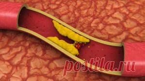 Холестерин. Норма в крови. Снижение. Лечение. - Болезни на KRASGMU.NET