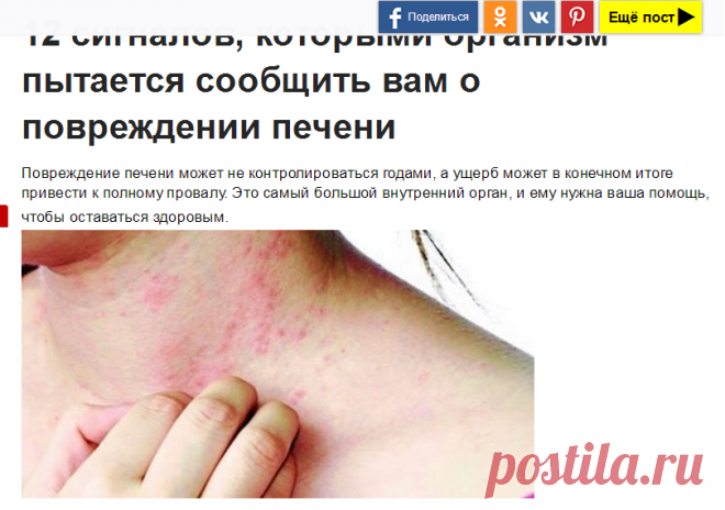 12 сигналов, которыми организм пытается сообщить вам о повреждении печени / Будьте здоровы