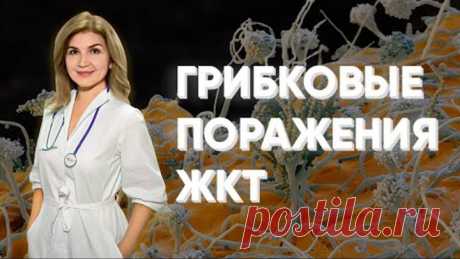 Грибковые поражения ЖКТ. Диагностика. Лечение.