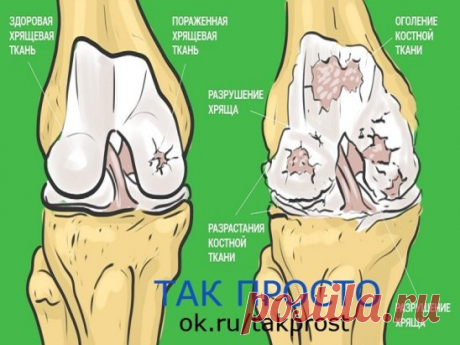 О пользе желатина