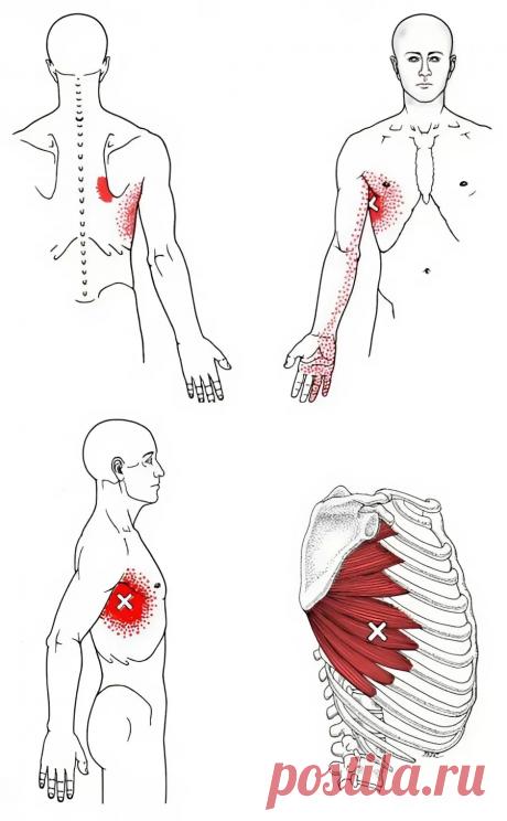 Межреберные мышцы. Самомассаж