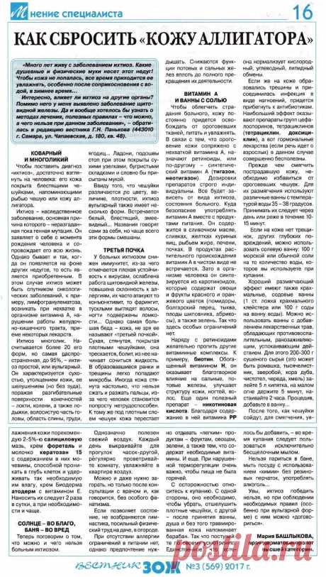 Ихтиоз