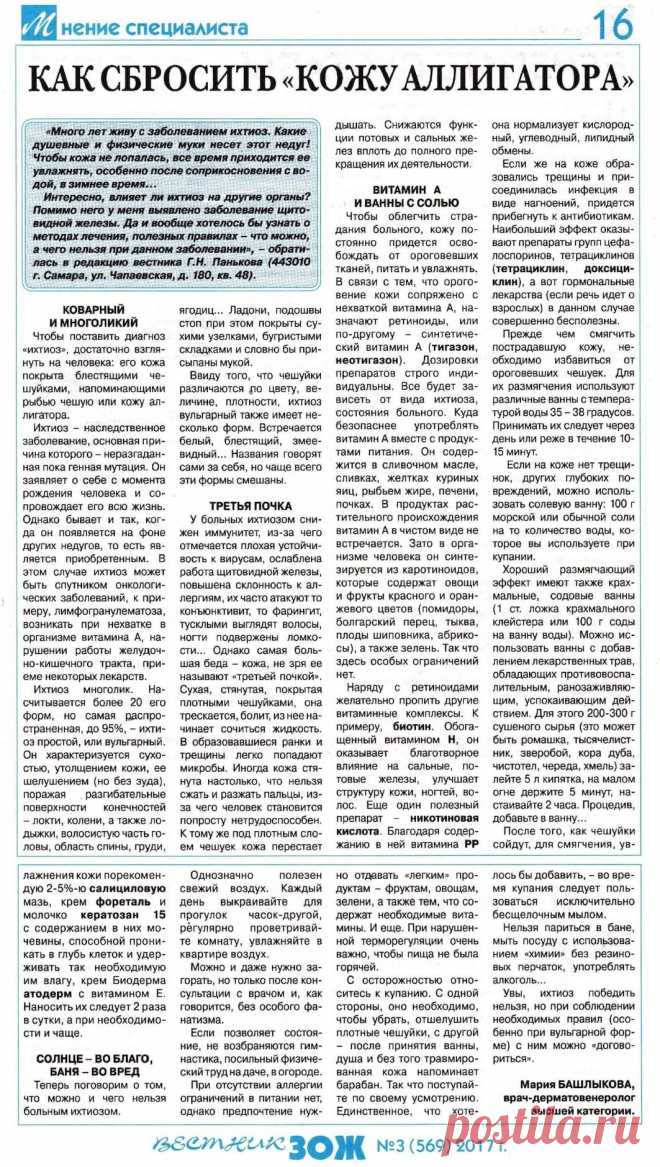 Ихтиоз