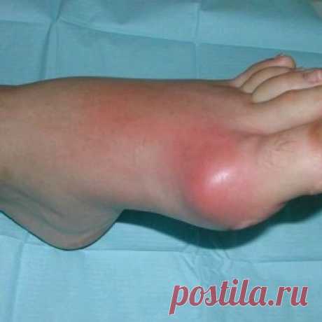 Преображение сломанных и испорченных вещей - МирТесен