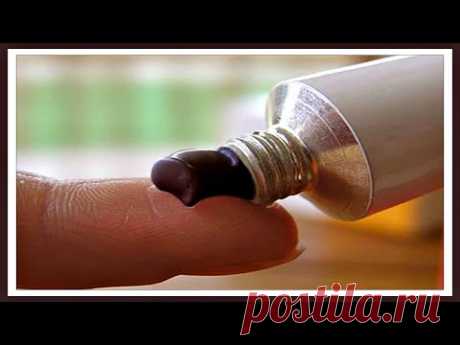 Папилломы Отвалятся САМИ. Просто Нанесите ТОЛСТЫМ слоем КОПЕЕЧНУЮ аптечную мазь.