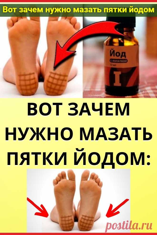 Вот зачем нужно мазать пятки йодом