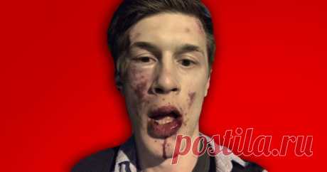 Оппозиционера Егора Жукова избили в Москве У него сотрясение мозга.